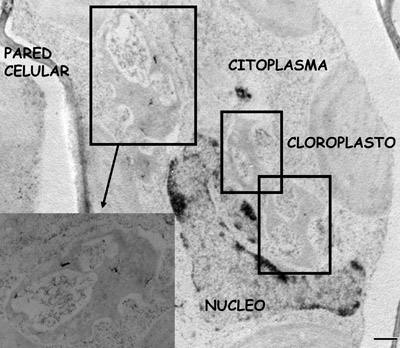 Factorías virales inducidas por MNSV